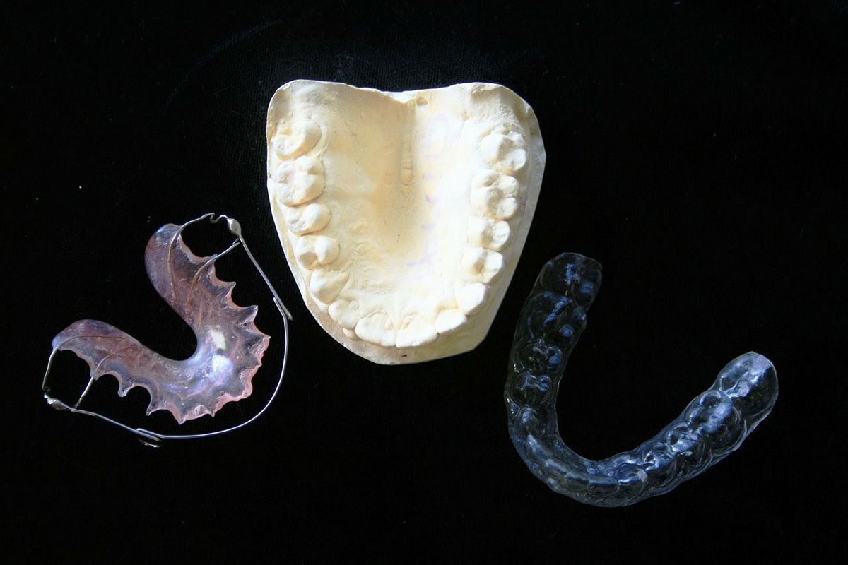 Les dangers de l’auto-traitement orthodontique