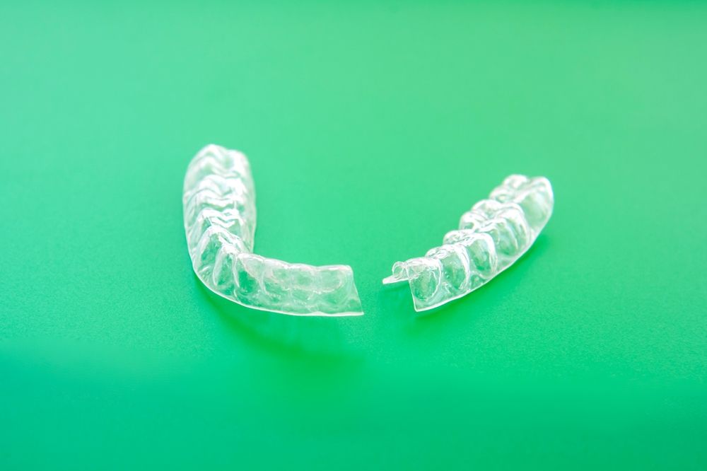 Gouttière Invisalign perdue, fissurée ou déformée : que faire avant de passer à la suivante ?