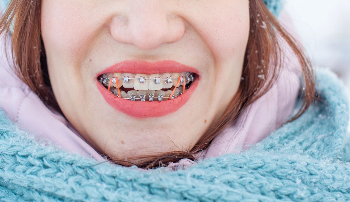 Comment prendre soin de son appareil orthodontique pendant la saison froide