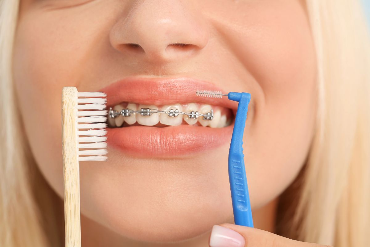 Les r&eacute;solutions dentaires 2025 : de meilleures habitudes avec un appareil orthodontique