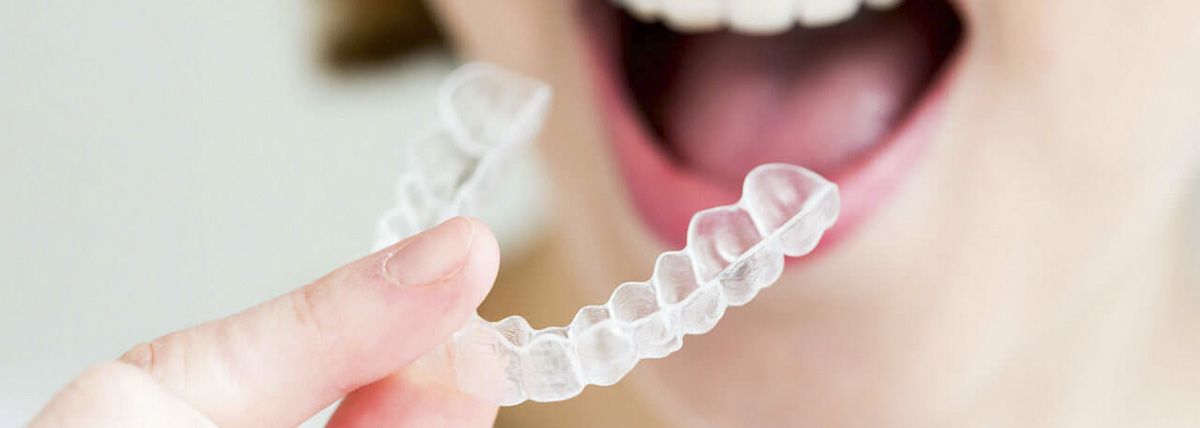 Qu’est-ce qui fait la particularité et le succès d’Invisalign?