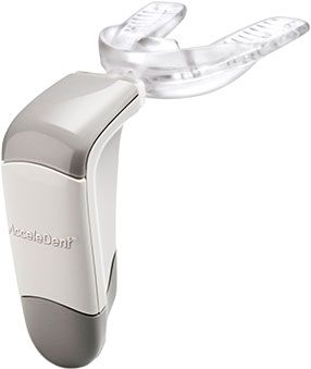 ACCELE DENT : la nouvelle technologie qui accélère les traitements en orthodontie