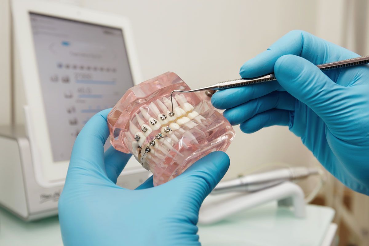 Qu’est-ce que l’orthodontie peut corriger?