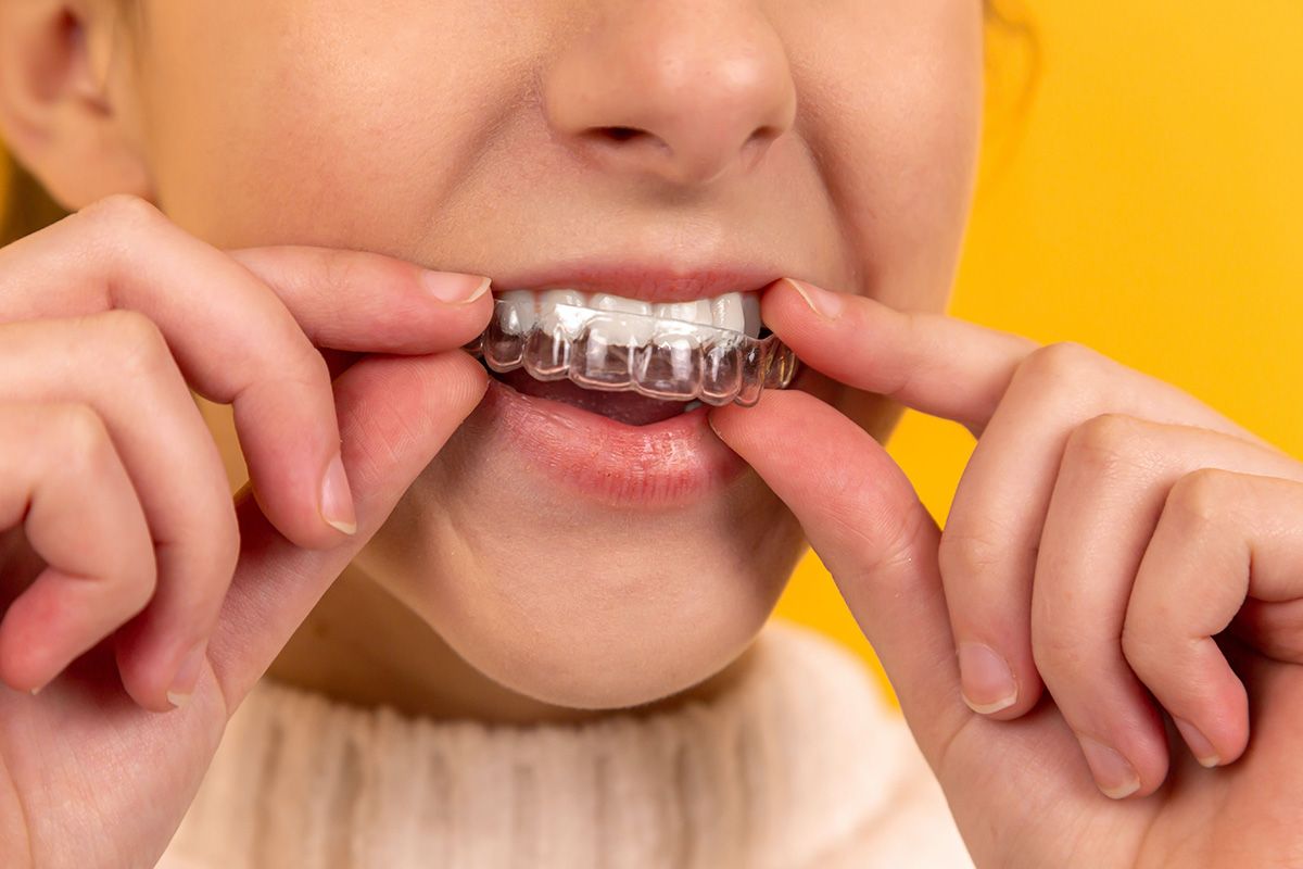 3 traitements orthodontiques qui n’existaient pas 5 ans passés